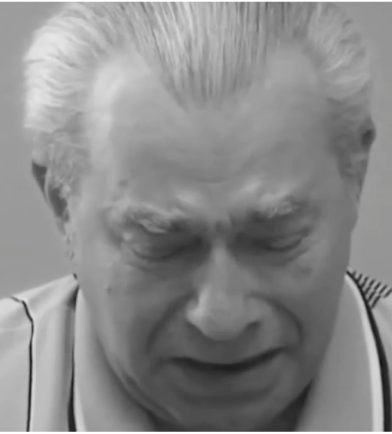 Male patient experiencing a Pseudobulbar Affect (PBA) crying episode that appears as a grimace