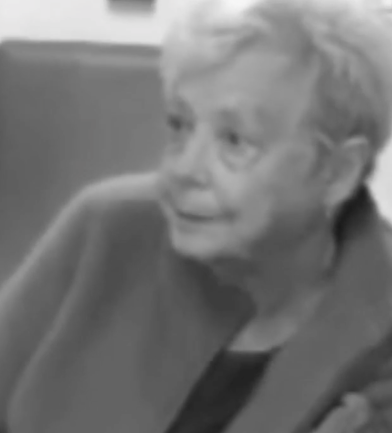 Female patient experiencing a Pseudobulbar Affect (PBA) crying episode without tears