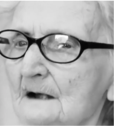 Female patient experiencing a Pseudobulbar Affect (PBA) crying episode that is quiet