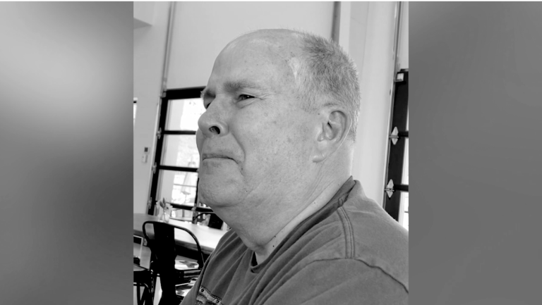 Male patient experiencing a Pseudobulbar Affect (PBA) crying episode that is brief and without tears